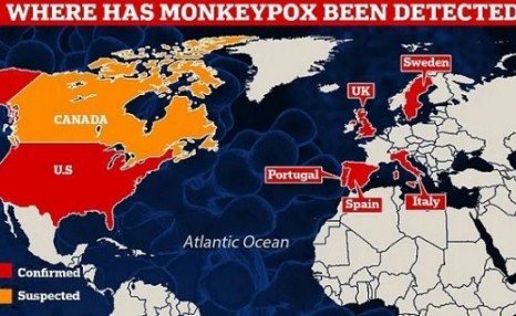 欧美猴痘病例持续增加 世卫组织：未有大规模暴发